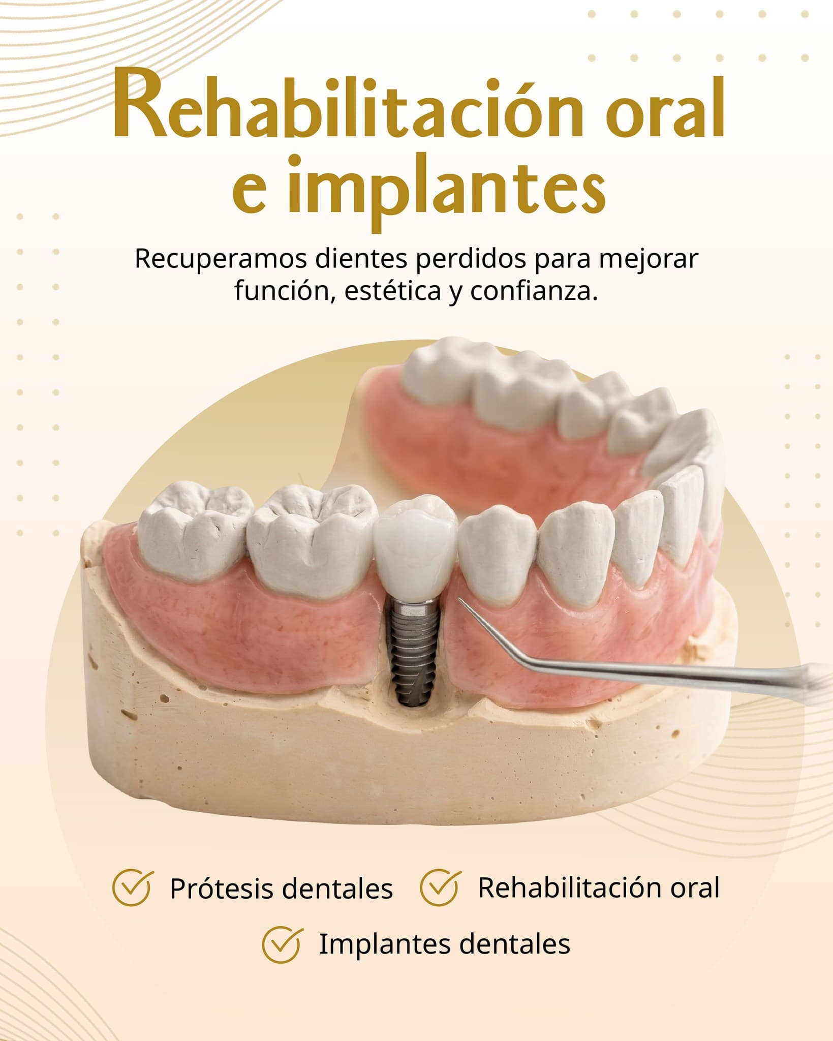 Rehabilitación oral e implantes — Recuperamos dientes perdidos para mejorar función, estética y confianza.